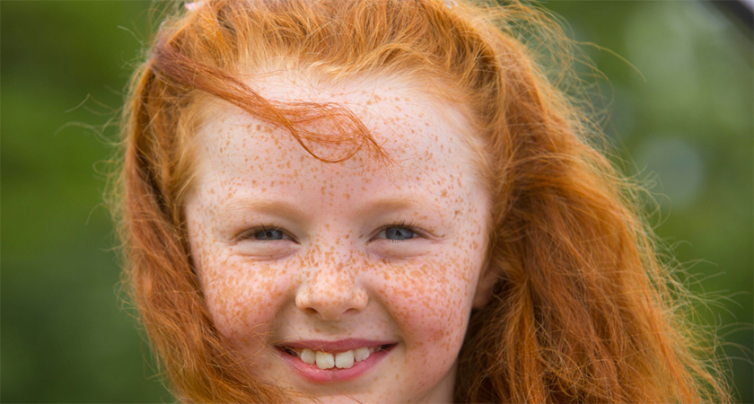 Sun Screen Fun And Freckles Annual Redhead Convention Gets Ready To Take Over Cork The