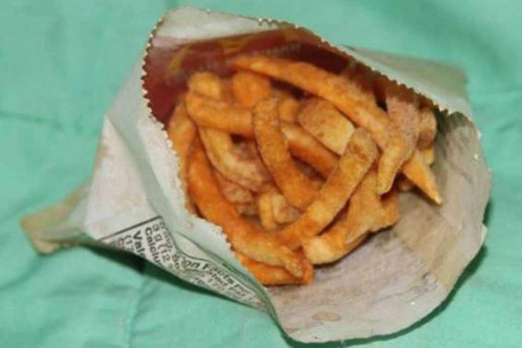 A six-year-old portion of McDonald's fries.