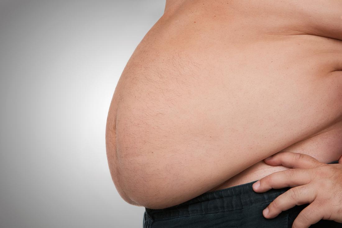 Michael Buerk: Let obese people die early to save NHS money, UK News